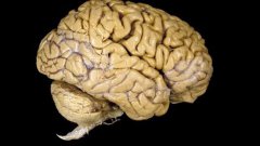 What can you do without a brain?