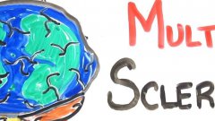 Multiple sclerosis